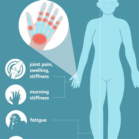 Can anxiety cause swelling of joints stiffness and a feeling of malaise ...