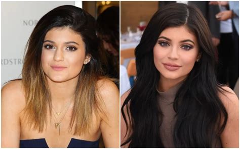 Kylie Jenner After & Before Pictures: Did She Do Surgery? - Demotix.com