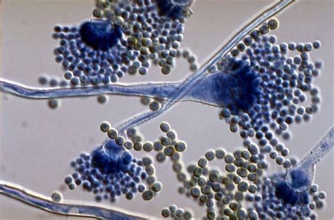 Aspergillus flavus under microscope | Medical Laboratories