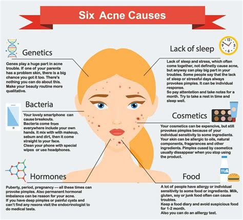 Acne: Types, Symptoms, Causes & Treatments