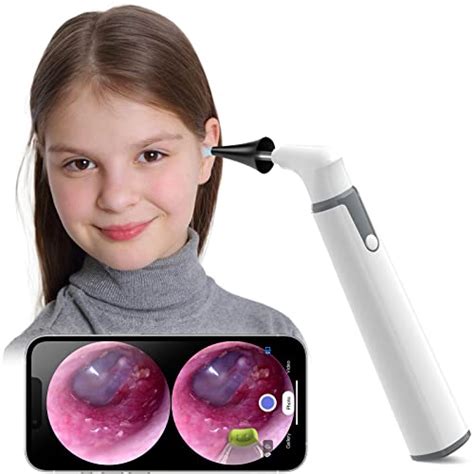 Top 10 Best Digital Otoscope For Iphone : Reviews & Buying Guide - Katynel