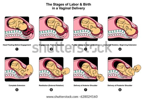 Stages Labor Birth Vaginal Delivery Infographic Stock Illustration ...