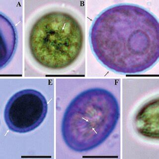 The cell wall of the sporangia (A) and vegetative cells (B-G) of IRK-A ...