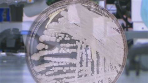 CDC warns emerging fungus can cause severe, deadly infections in ...