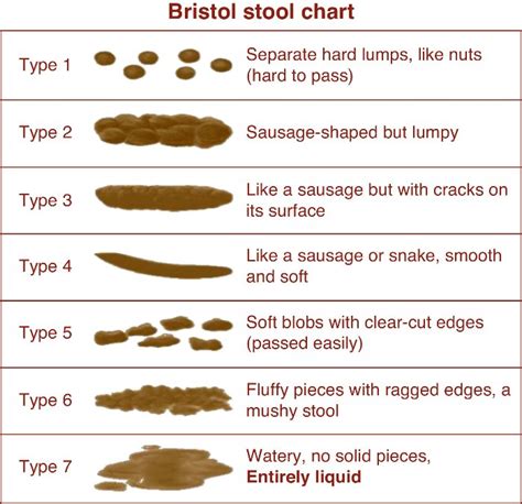 Bristol-stool-chart - Jay Yepuri, MD