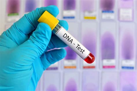 Dna Testing Market Size, Share, Growth | Forecast to 2027