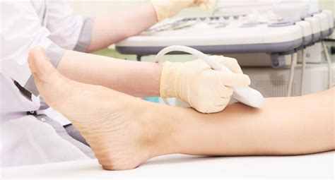 Vascular Ultrasound Studies | Michigan Vein Doctor