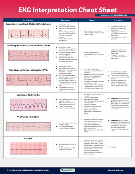 Ekg Practice Strips Printable With Answers