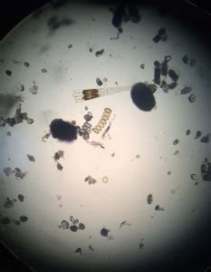 Plankton under microscope - Morro Bay National Estuary Program