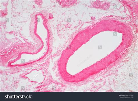 Vein Histology: Over 608 Royalty-Free Licensable Stock Photos ...