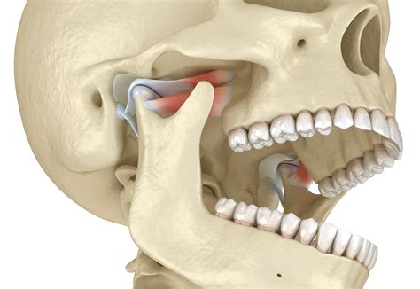 When Your Jaw Joints Don’t Work Properly Anymore | Cedar Rapids, IA