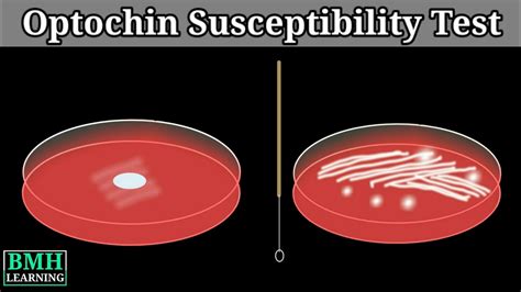 Optochin Susceptibility Test | Optochin Disc | Optochin Susceptibility ...