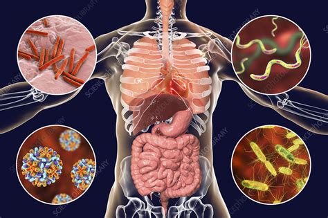 Bacteria that cause human infections, illustration - Stock Image - F023 ...