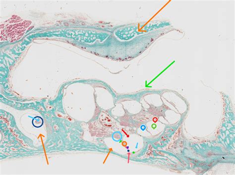 ear (cochlea) histology Diagram | Quizlet