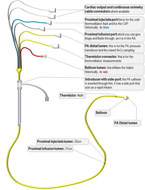 edwards swan ganz pulmonary artery catheter proximal port - Google ...