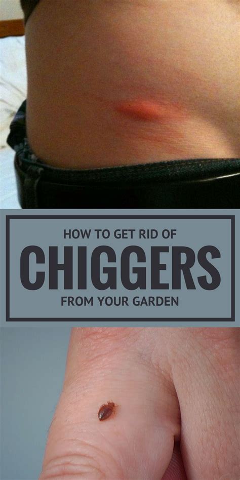 How To Get Rid Of Chiggers From Your Garden | Garden pest control ...