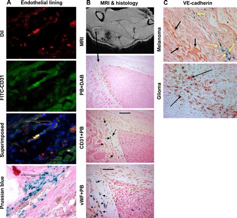 Immunohistochemistry showing endothelial markers in administered cells ...