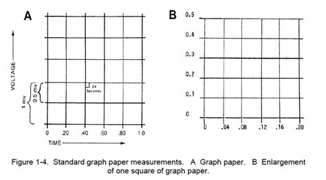 1-05. GRAPHIC DISPLAY OF ELECTROCARDIOGRAM (B) | Cardiac Rhythm ...