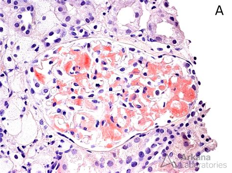 Congo Red Stain Tutorial | Teaching Points | Arkana Laboratories