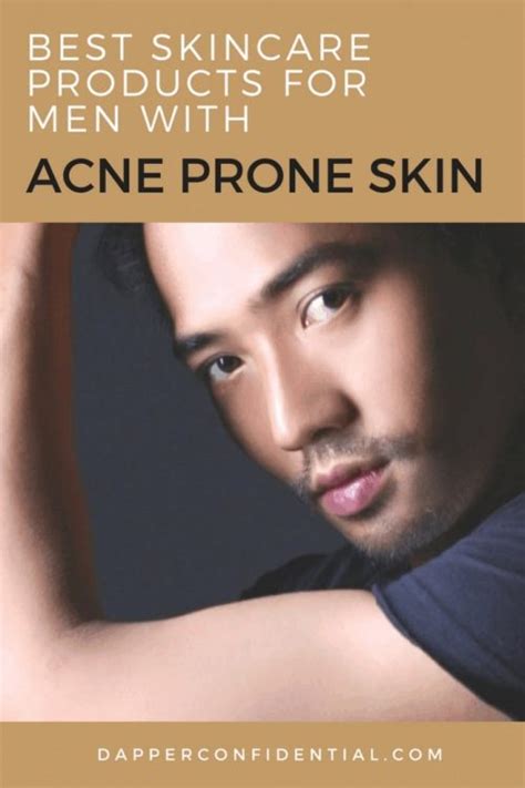 Best Skincare Products for Men with Acne Prone Skin