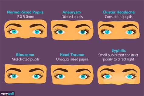 Pupil Size and Your Health