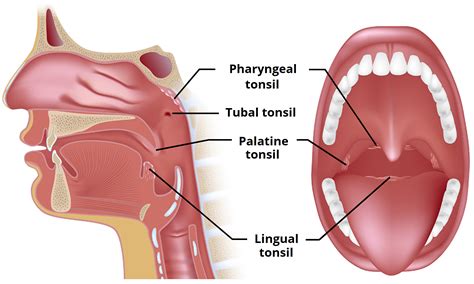 The Tonsils (Waldeyer's Ring) - Lingual - Pharyngeal - Palatine - Tubal ...