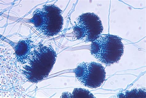 A. fumigatus Archives - Page 5 of 10 - Aspergillus and Aspergillosis