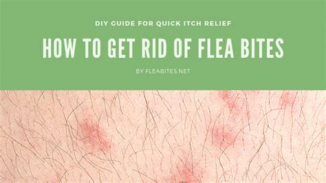 Flea Bite Treatment - How to Get Rid of Flea Bites - FLEABITES