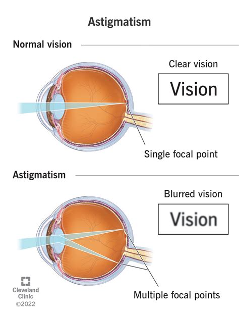 Astigmatism Test