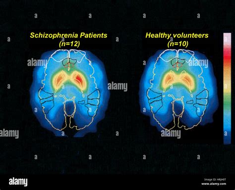 Pet Brain Scan