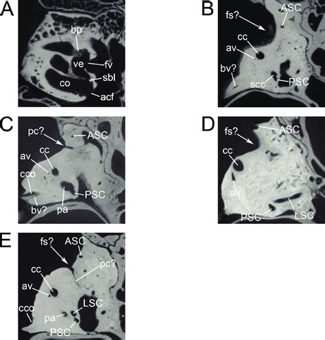 µCT images of the bony labyrinth in Pantherinae showing the bony ...