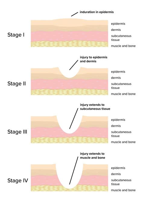 Wound Care Manual and Clinical Guidelines for Nurses | Ausmed