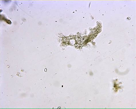 Live Amoeba 100X: General Biology Lab: Loyola University Chicago