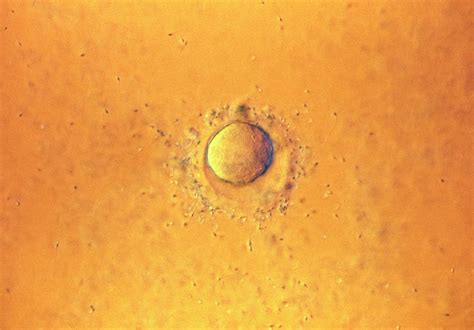 Lm Of Sperm On Egg During Fertilisation Photograph by Science Pictures ...