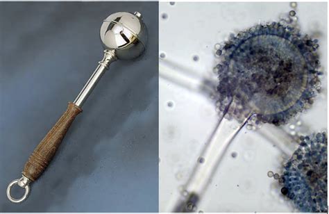 Aspergillus: New Gene Test Screens Patients at Risk For Fungal ...