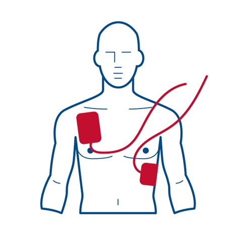 What is an AED? Everything You Need to Know and More | Seton