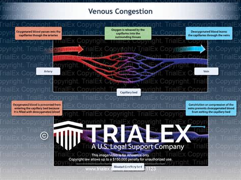 Venous Congestion - TrialQuest Inc.