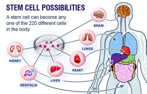 HC allows Stem Cell Therapy for autistic kids - Civilsdaily