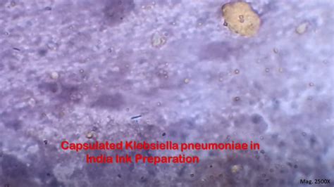 Negative Staining for Bacterial Capsule Demonstration: Introduction, Princ