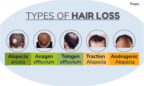 Stress Causing Hair Loss: Myth Or Fact? – Traya