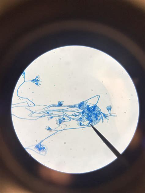 First mycology lab : observed penicillium under a microscope : r ...