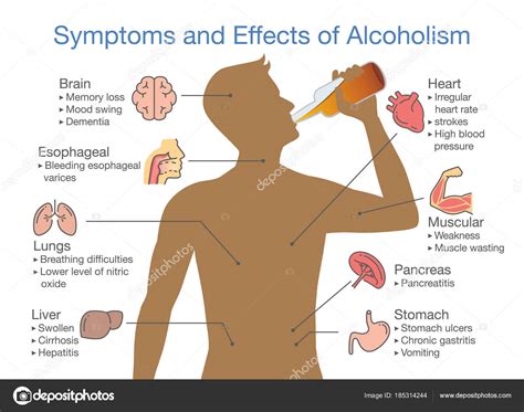 Signos De Alcoholismo