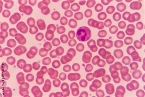 Normal red blood cells Under the microscope Stock Photo | Adobe Stock