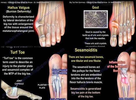 What’s Causing a Sharp Pain in My Big Toe? | SeeReadShare