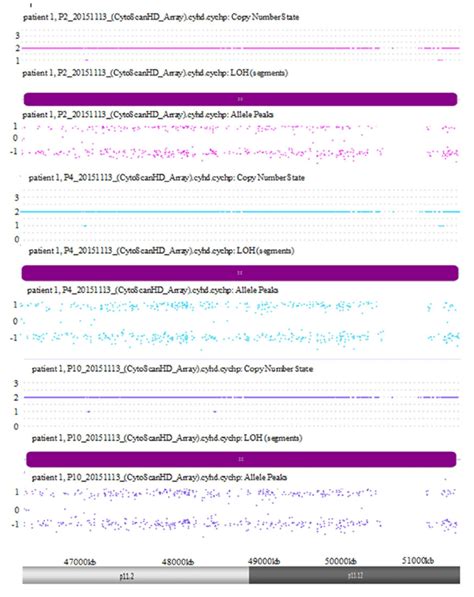 Example of cn-LOH detection using SNP array analysis. Three different ...