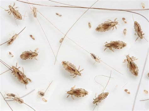 Head lice on babies | BabyCenter