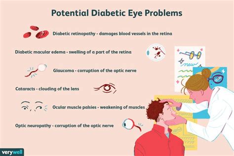 Diabetes Eye Exams: Uses, Side Effects, Results