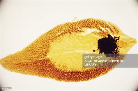 Fasciola hepatica viewed under a microscope, Platyhelminthes... News ...