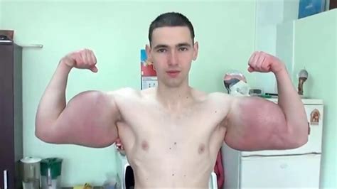 HINDI - 21 Years Old Guy Synthol Case......... - YouTube