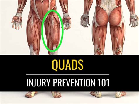 Injury Prevention 101: The Quads Exercises | Sports Injury Physio ...